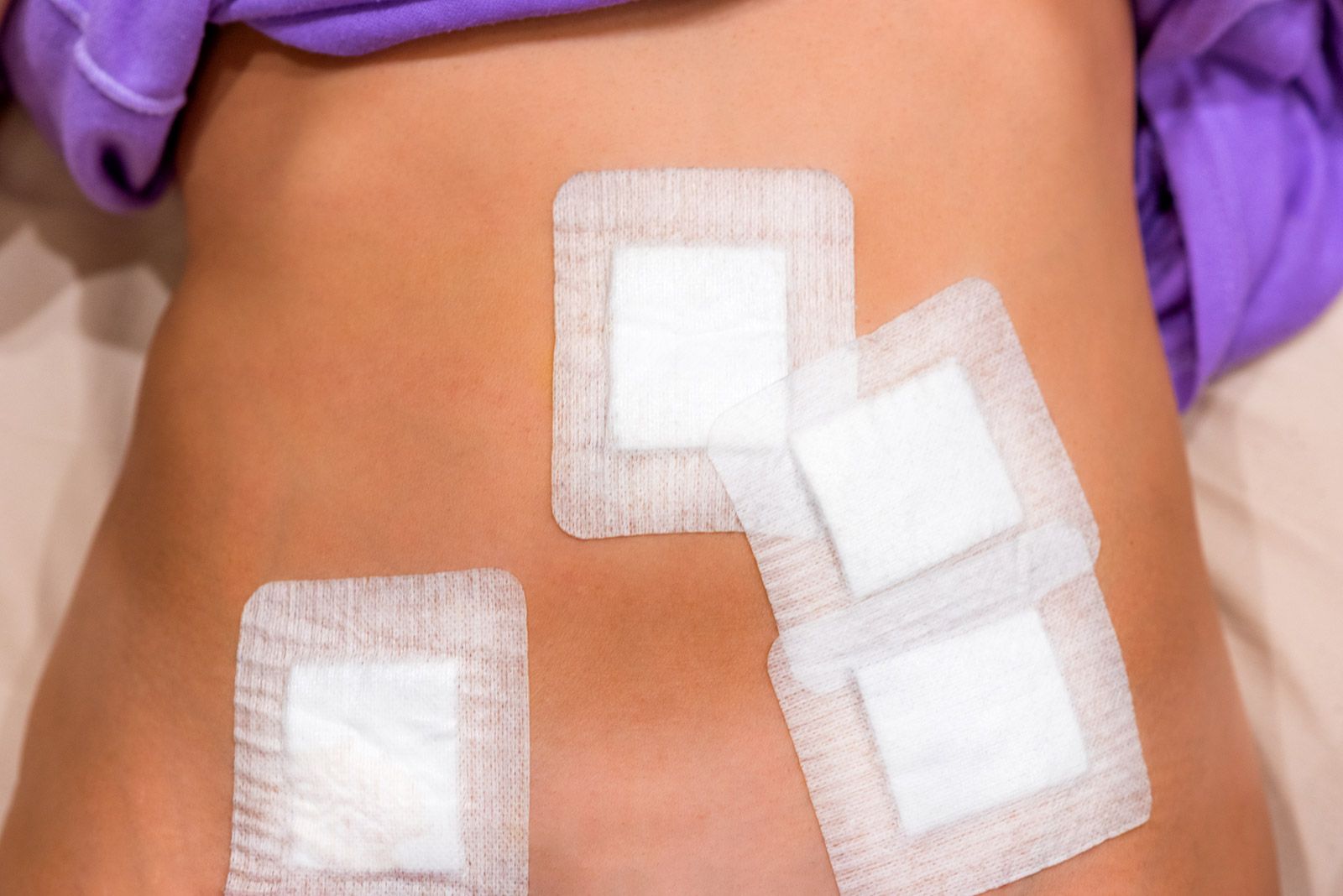 vitamin patches